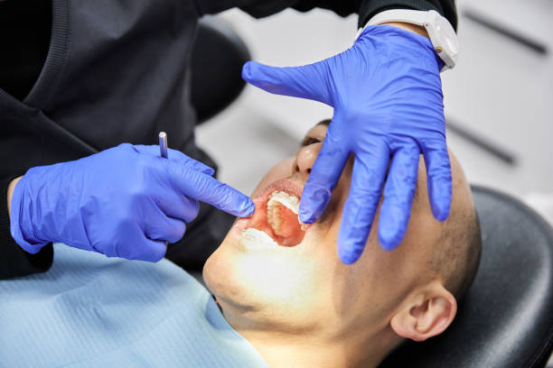 Best Emergency Wisdom Tooth Extraction in Greenbriar, FL